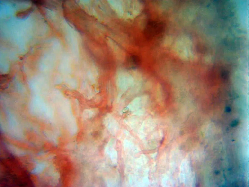 Microscopía de Lentinus scleropus - 10 - Pileipellis x 400